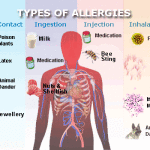 types-of-allergies